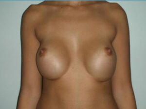 Before Image: Bottoming Out