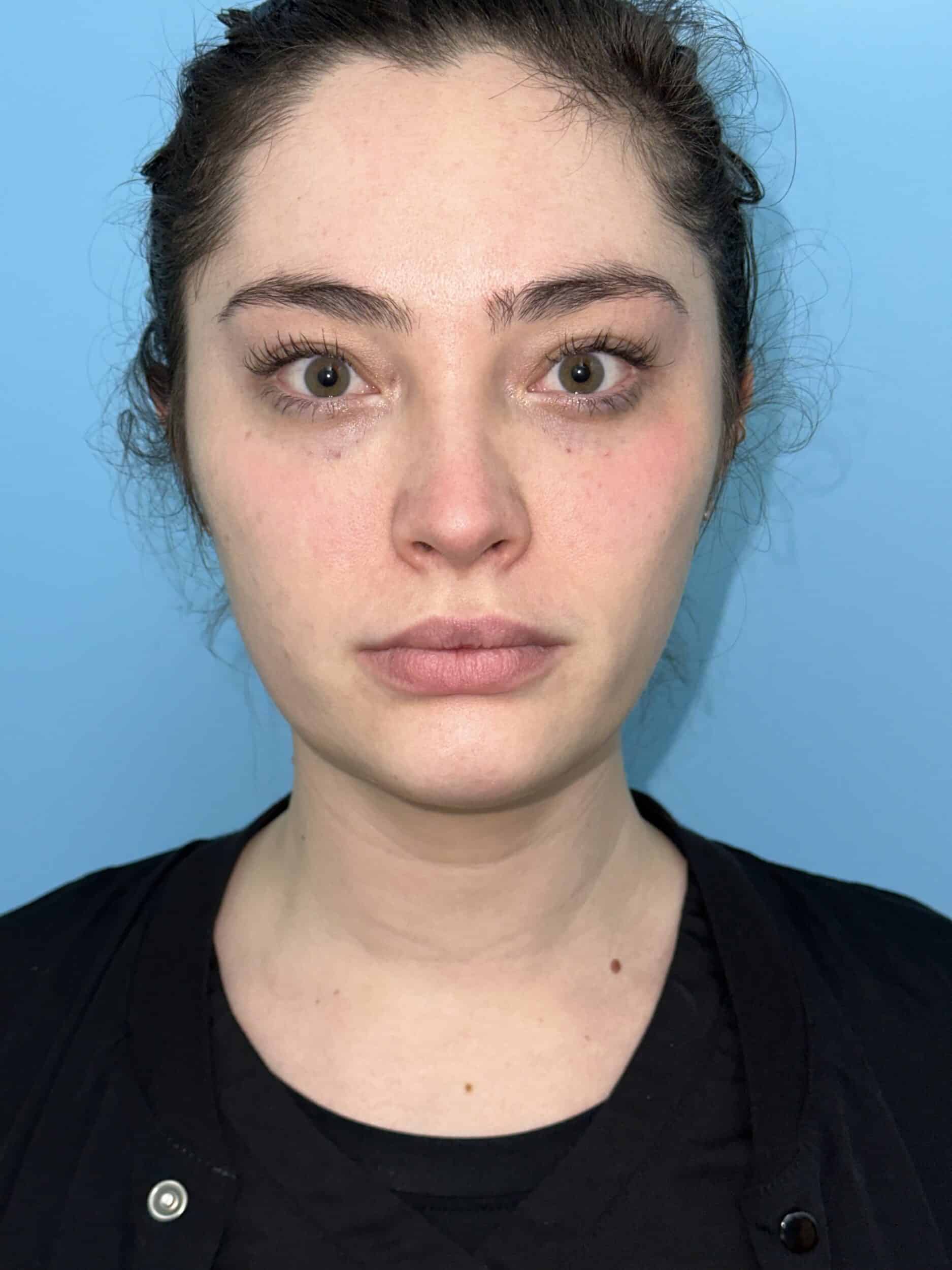 After Image: Eye Filler - front